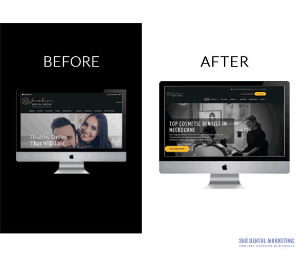 Before After