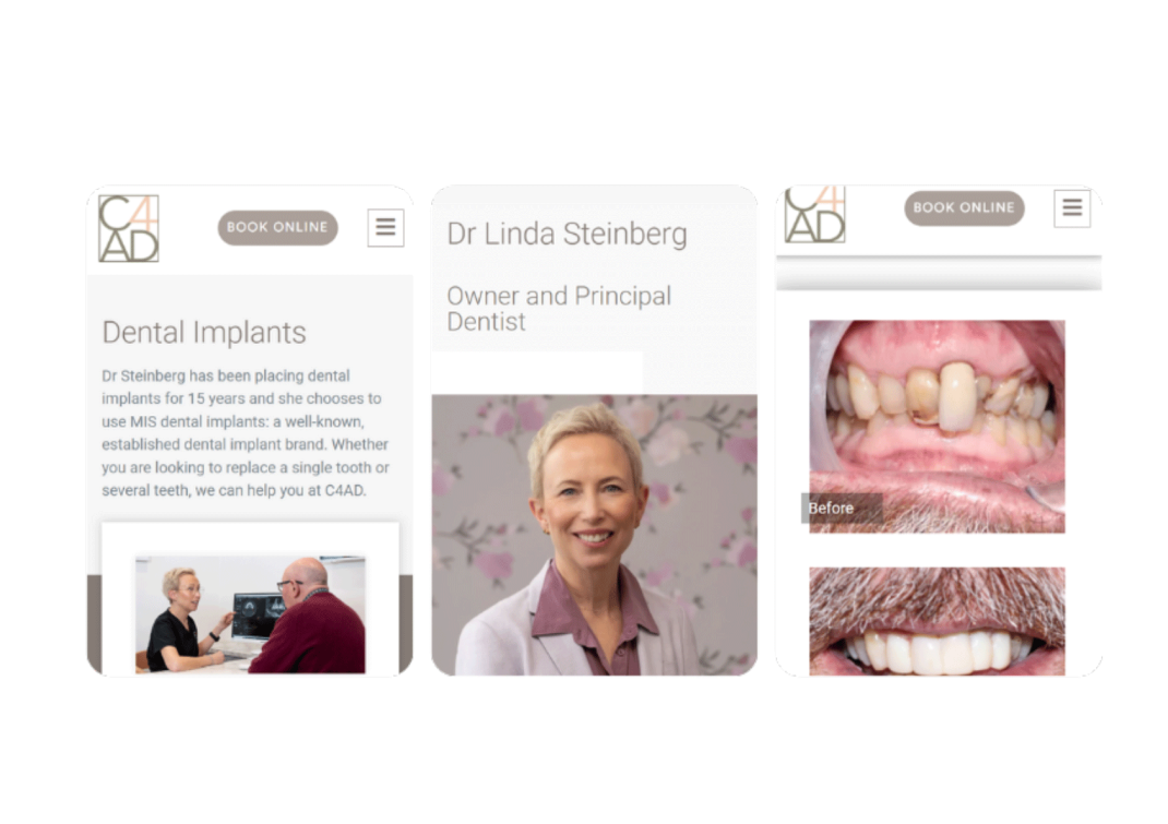 Linda Dental Implants